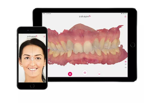 Software für digitales Lächelndesign - 3shape - Dental / Umform / Erfassung