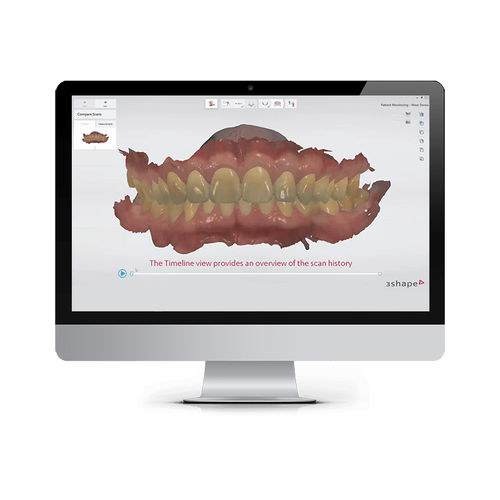 Monitoring-Software - 3shape - Diagnose / Umform / Erfassung