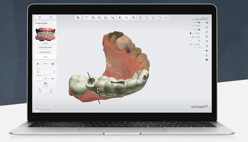 Planungssoftware - Implant Studio™ - 3shape - Umform / CAD / für Zahnprothese-Design