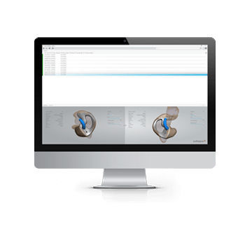 Dental-Software - 3shape - zur Qualitätskontrolle / CAD / zur Konzeption von Audioprothesen