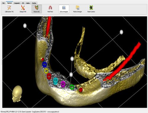 OP-Software - Winmed - ARTIGLIO SNC   - für dentale Bildgebung / Dental / 3D-Visualisierung