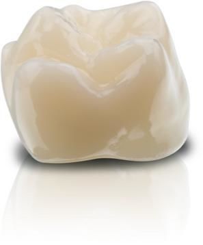 Hybrides zahnmedizinisches Material - VarseoSmile&reg; Crown plus - BEGO - Hybridkeramik / Harz / für Dentalkronen