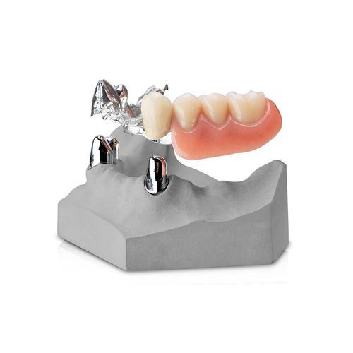 Metall-Zahnprothese - WIRONIUM&reg; RP Hybrid - BEGO - Kobaltchrom / CoCr / nach Maß