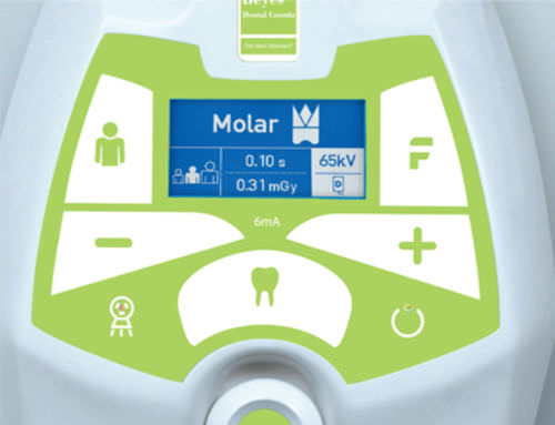 Intraorales Röntgensystem - Duray DC - Beyes Dental Canada - mit Wandhalterung / digital oder analog