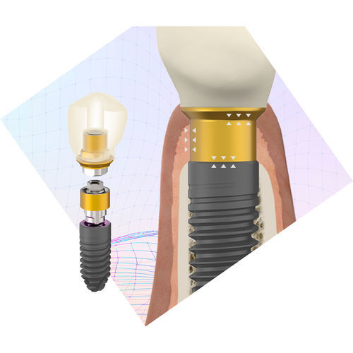 Zylindrisches Implantat-Abutment - BioBlock® - BTI Biotechnology Institute - Titan / mit Außenverbindung / gerade