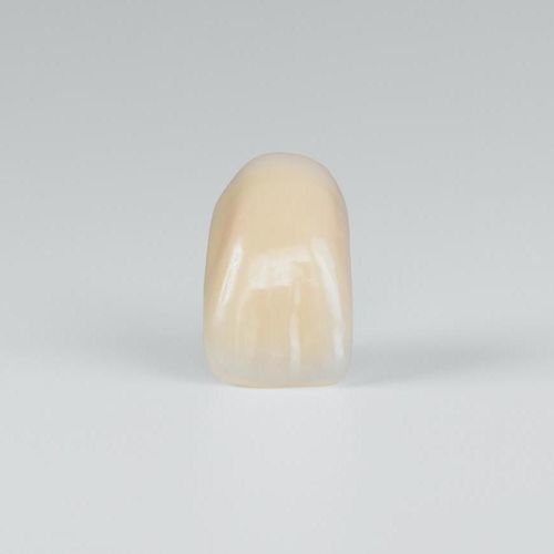 PMMA-Zahnprothese - PhysioStar NFC+ - Candulor - für Vorderzähne / für Seitenzähne / lichtdurchlässig