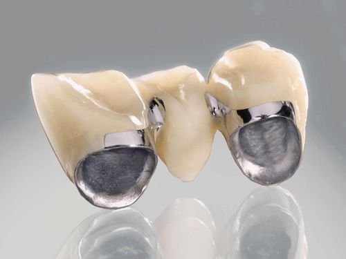 Zahnmedizinisches Material / Keramik - remanium® secura - DENTAURUM - CoCr / für Zahnbrücken / für Dentalkronen