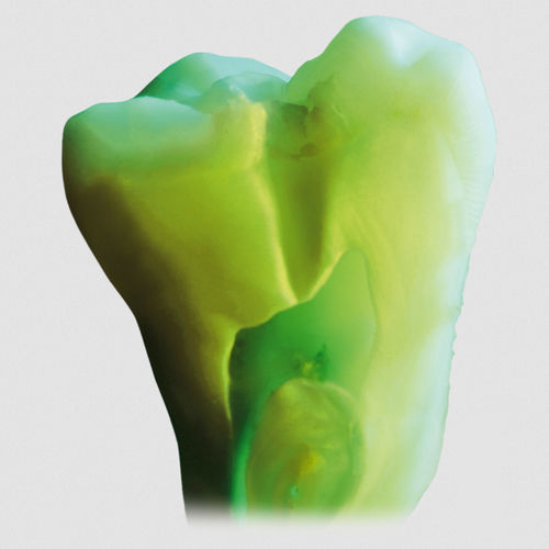 Zahnmedizinisches Material / Keramik - ceraMotion® Zr - DENTAURUM - zur Keramikbeschichtung / Paste / transparent
