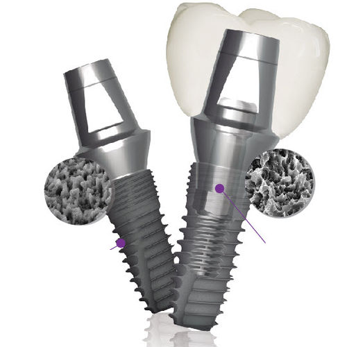 Konisches Zahnimplantat - Implantium II  - Dentium - Titan / inneres Sechseck