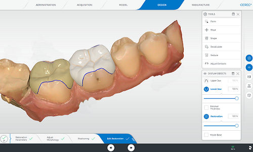 Analysesoftware - CEREC - DENTSPLY MAILLEFER - Monitoring / Erfassung / für Dentallabor