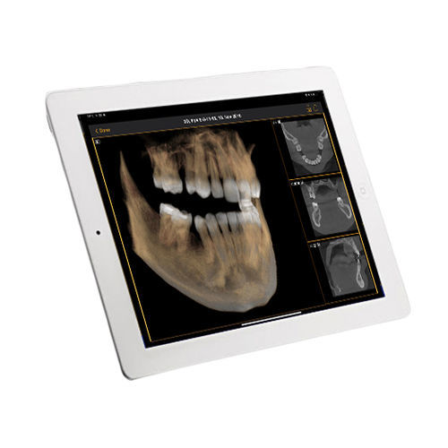 Visualisierungssoftware - Sidexis iX - DENTSPLY MAILLEFER - Beschaffung / Umform / Sicherheit