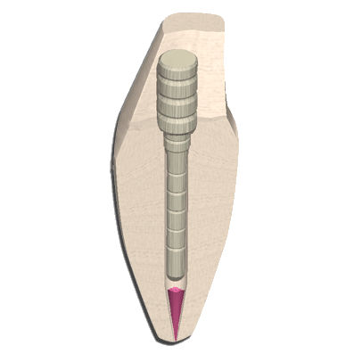Faser-Wurzelstift - EZ-Fit&reg; Fiber - ESSENTIAL DENTAL SYSTEMS  