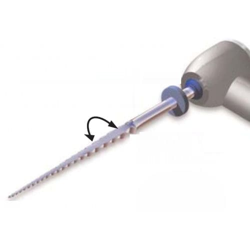Zahnraspel - SafeSiders® - ESSENTIAL DENTAL SYSTEMS  