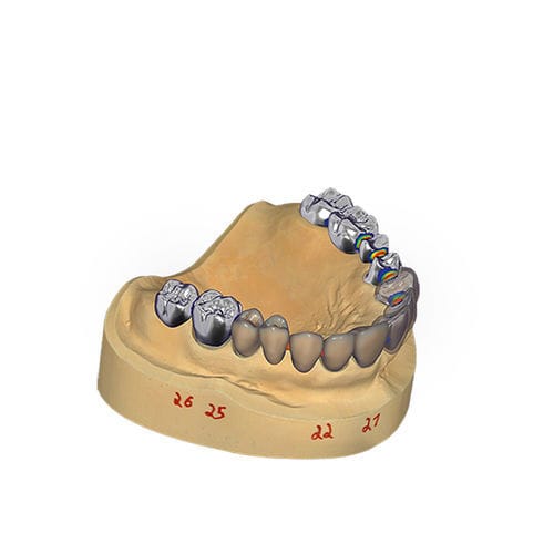 Projektentwicklungssoftware - DentalCAD - exocad GmbH   - CAD / Ausbildung / Modellierung