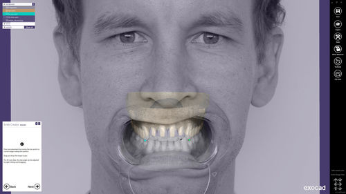 Analysesoftware - Smile Creator - exocad GmbH   - Planung / Projektentwicklung / CAD