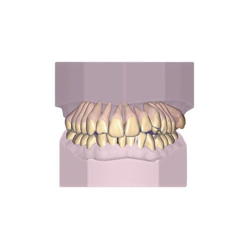 Software-Modul / Projektentwicklung - Ortho - exocad GmbH   - Modellierung / Archivierung / orthodontisch