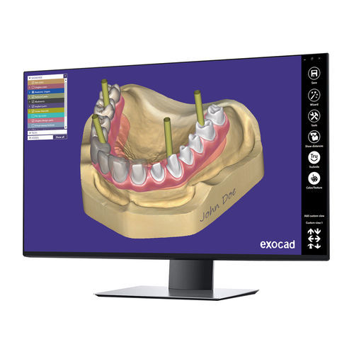 Software-Modul / Projektentwicklung - Implant  - exocad GmbH   - CAD / für Dentalimplantologie