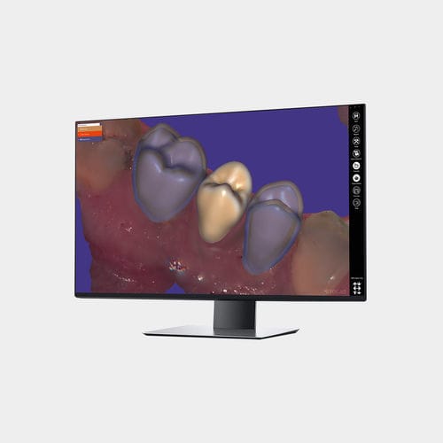 Software-Modul / Erfassung - Provisional  - exocad GmbH   - Steuerung / CAD / Dental