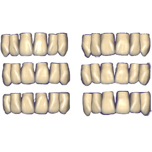 Software-Modul / CAD - Tooth Library - exocad GmbH   - Dental / Zahn / Kiefer
