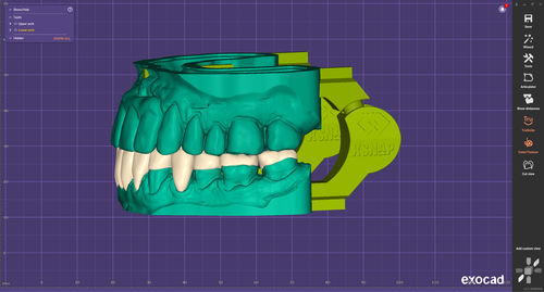 Software-Modul / CAD - xSNAP - exocad GmbH   - Druck / Dental / Gelenk
