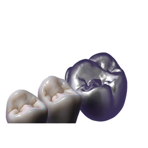 Software-Modul / Steuerung - TruSmile  - exocad GmbH   - Projektentwicklung / CAD / zur Dentalrestaurierung