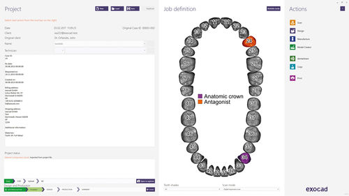 Management-Software - dentalshare - exocad GmbH   - Projektentwicklung / CAD / Content-Sharing
