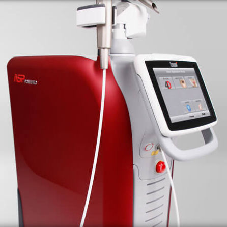 Laser für Lipolyse - TimeWalker® Fotona4D® - Fotona - Nd:YAG / Er:YAG / auf Wagen