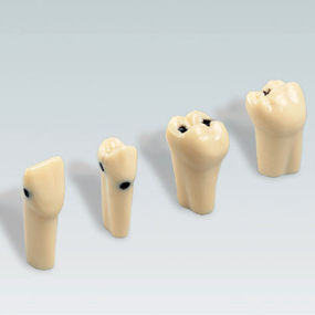 Anatomisches Modell / Zahn - AG-3 ZKN - frasaco - für die Ausbildung / Karies