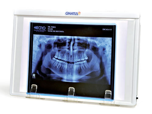 Röntgenfilmbetrachter / 1 Betrachtungsfläche - Gnatus - mit Schalter / Dental / Weißlicht