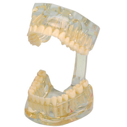 Anatomisches Modell / Gebiss - 355641 - Hager & Werken - für Vorführzwecke / transparent