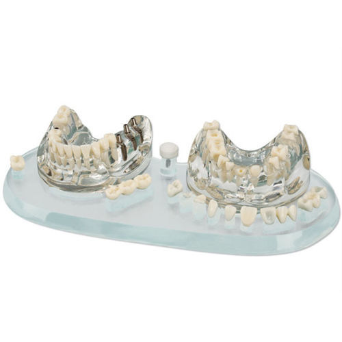 Anatomisches Modell / Gebiss - 355638 - Hager & Werken - für Implantologie / für Vorführzwecke