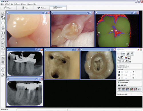 Visualisierungssoftware - DBSWIN  - Dürr Dental - Diagnose / Planung / Projektentwicklung