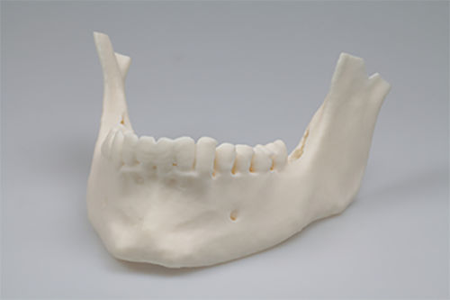 Zahnmedizinisches Material / Harz - Invicta 915 - DWS Systems - für 3D-Druck / zur Modellierung / flüssig