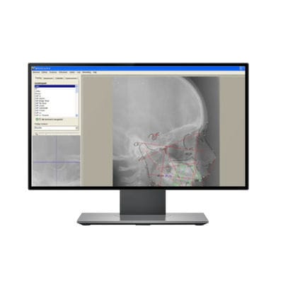 Software für dentale Bildgebung - DFO - IMAGELEVEL - für orthopädische Bildgebung / Fernröntgen / für Tablet-PC