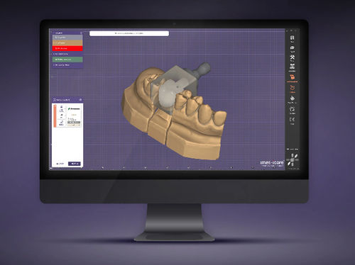 CAD-Software - iCAM one - imes-icore GmbH - Dental / Dental