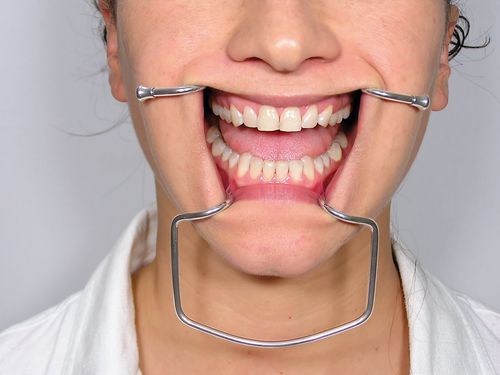 Wangenretraktor - CRO2 - Jakobi Dental GmbH - Dental / für Erwachsene / Edelstahl