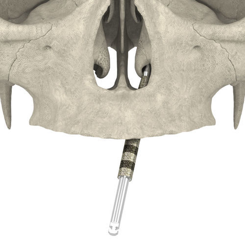 Bohrer für Dentalimplantologie - JDNasal TranZ  - JDENTALCARE SRL   - Dekorputz / Diamant