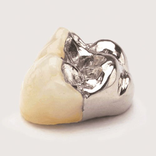 Zahnmedizinisches Material / Porzellan - JPW - Jensen Dental   - zur Dentalrestaurierung / für Zahnbrücken / fest