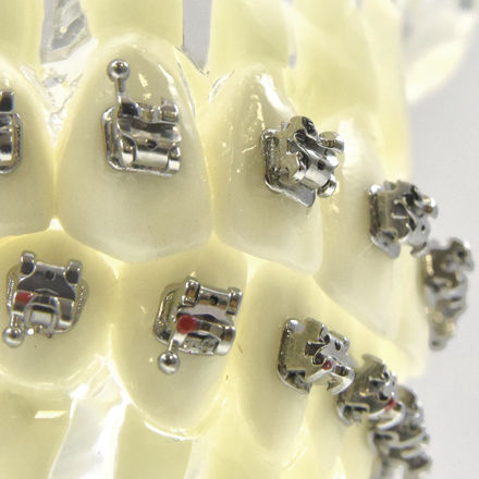 Selbstabklemmendes Orthodontie Bracket - InterActive SL - LEONE S.p.a.   - mit schwacher Reibung / mit vertikalem Slot