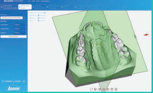 Projektentwicklungssoftware - LEONE S.p.a.   - CAD / FAO / für Dentallabor