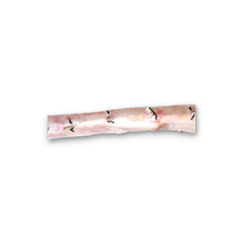 Thoraxaorta vaskuläre Bioprothese - CardioGraft® - Lifenet Health   - allograft