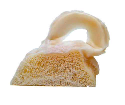Meniskus-Prothese / allograft - FlexiGRAFT®  - Lifenet Health  