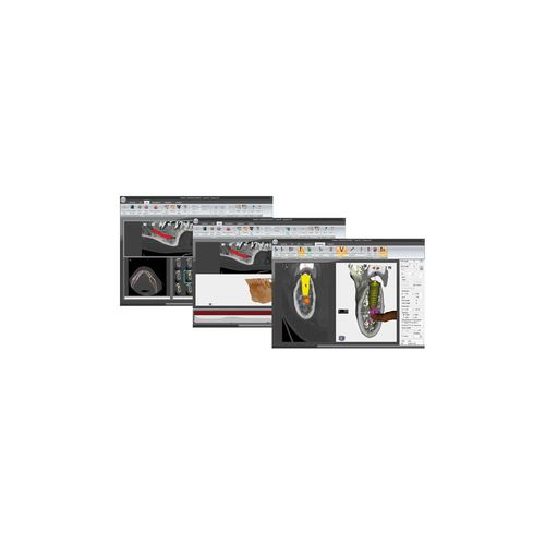 3D-Simulation-Software - S3D - MARIOTTI & C - für Dentalimplantologie / Knochen / Unterkiefer