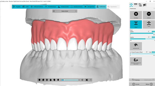 Dental-Software - BDCreator® PLUS - Merz Dental GmbH   - Analyse / Projektentwicklung / Import