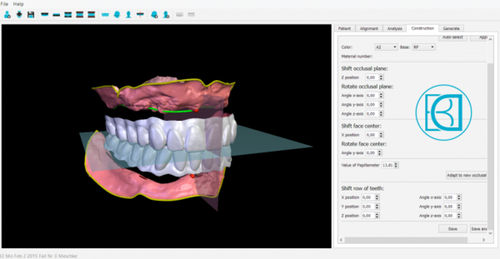 Laborsoftware - BDCreator® - Merz Dental GmbH   - für Dentallabor / Analyse / Steuerung