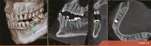 Software für dentale Bildgebung - i-Dixel 2.0 - Morita