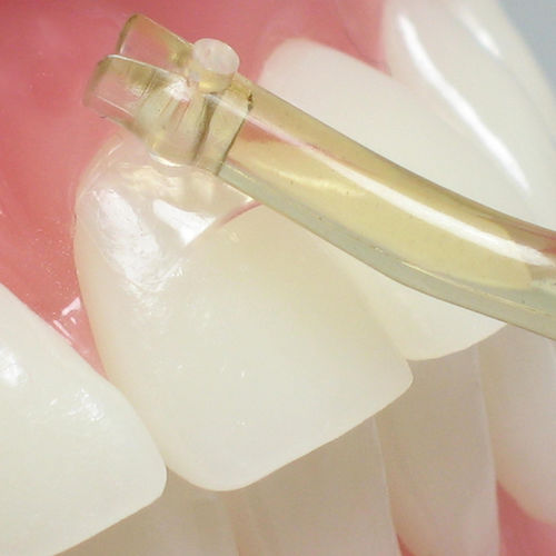 Zahnmedizinisches Material / PMMA - NA056 - Navadha Enterprises   - zur Dentalrestaurierung / transparent