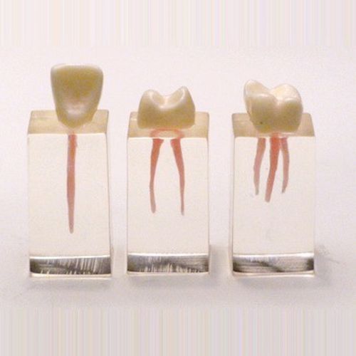 Anatomisches Modell / Zahn - SP010 - Navadha Enterprises   - für Endodontie / für die Ausbildung