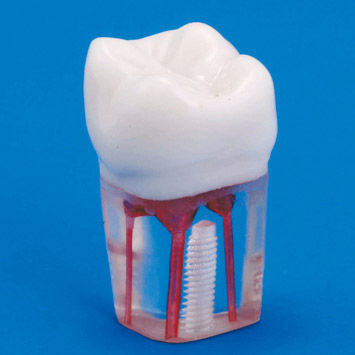 Anatomisches Modell / Zahn - S12A-200 - Nissin Dental Products Inc.   - Wurzelkanal / Ausbildung / transparent