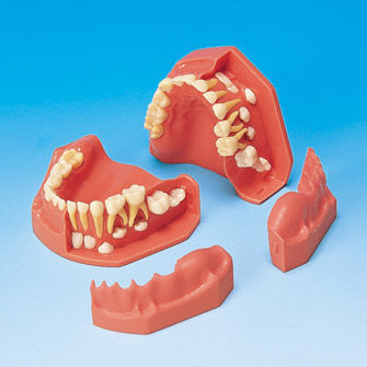 Anatomisches Modell / Gebiss - PE-PDI004 - Nissin Dental Products Inc.   - Zahnfleisch / für die Ausbildung / Kinder